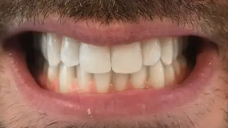 Nick-Dental-Emergency-After