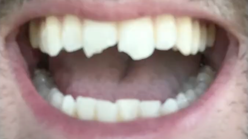 Nick-Dental-Emergency-Before